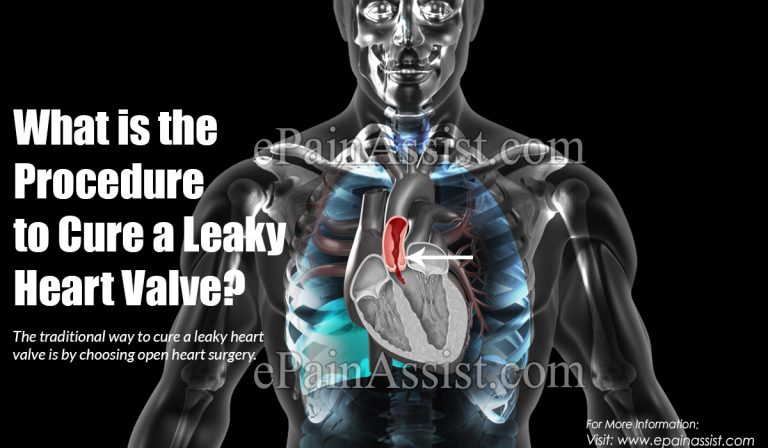 What is the Procedure to Cure a Leaky Heart Valve?