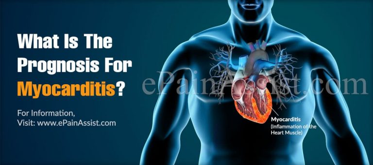 What Is The Prognosis For Myocarditis & How Can I Recover Fast?