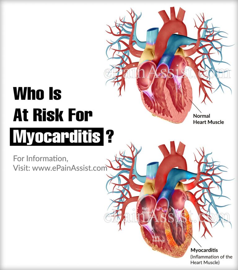 Who Is At Risk For Myocarditis?