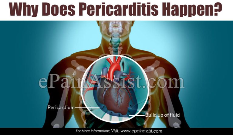 Why Does Pericarditis Happen?