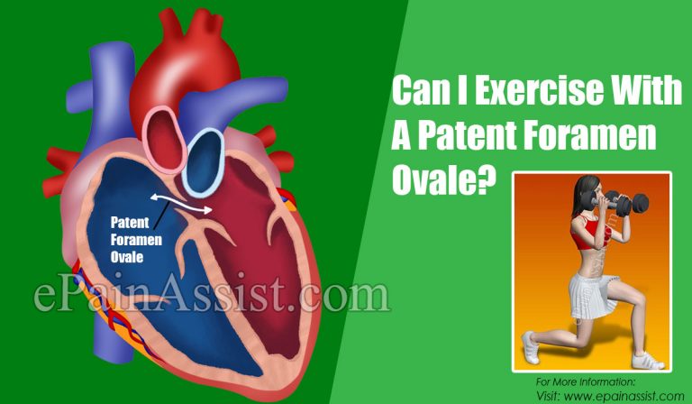 Can I Exercise With A Patent Foramen Ovale & Are There Any Home Remedies?