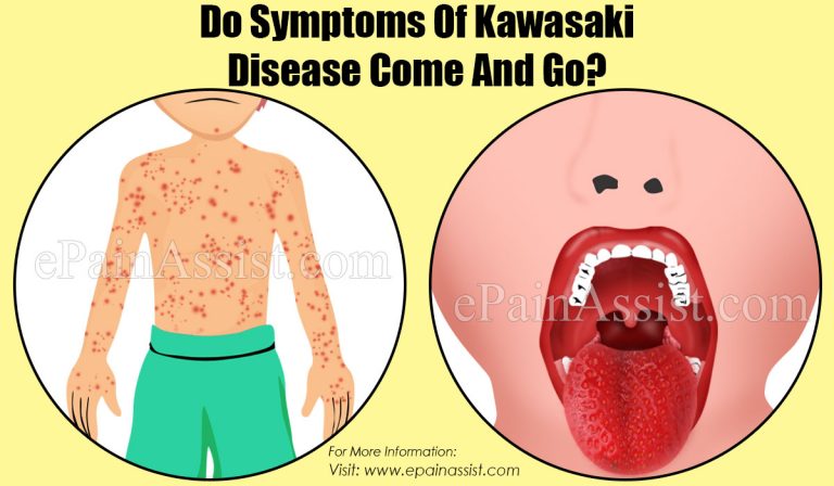 Do Symptoms Of Kawasaki Disease Come And Go?