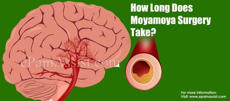 How Long Does Moyamoya Surgery Take?