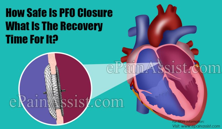 How Safe Is PFO Closure & What Is The Recovery Time For It & Can PFO Closure Cause AFIB?