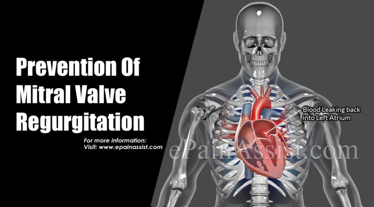 Prevention Of Mitral Valve Regurgitation