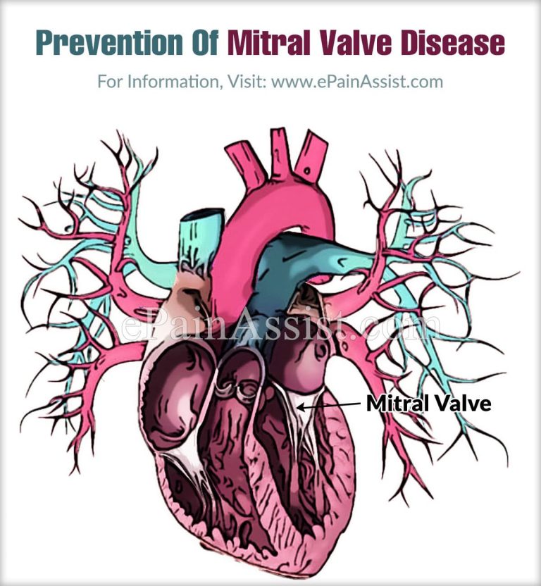 Prevention Of Mitral Valve Disease