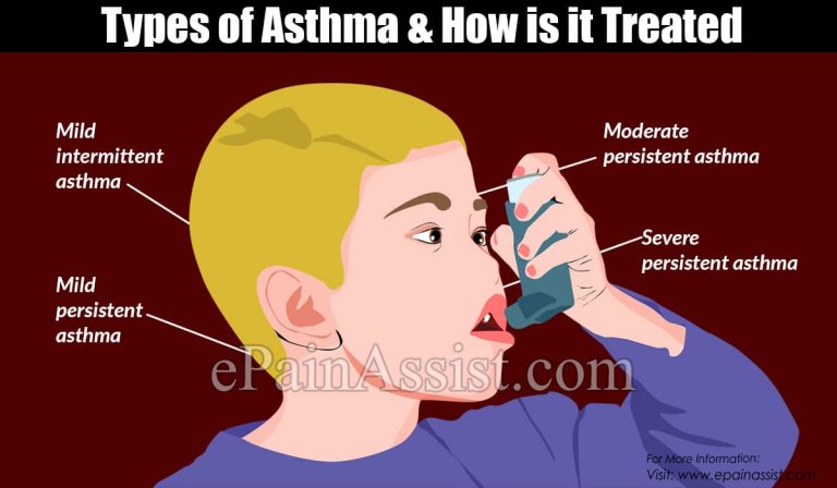 Types of Asthma & How Is It Treated?