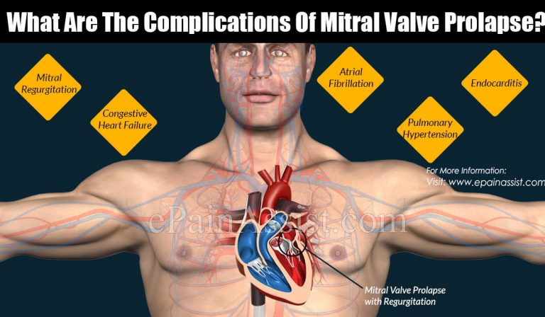 What Are The Complications Of Mitral Valve Prolapse?