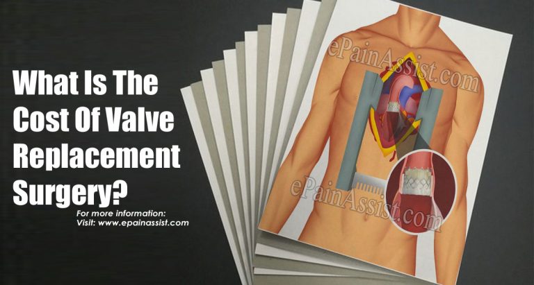 What Is The Cost Of Valve Replacement Surgery?