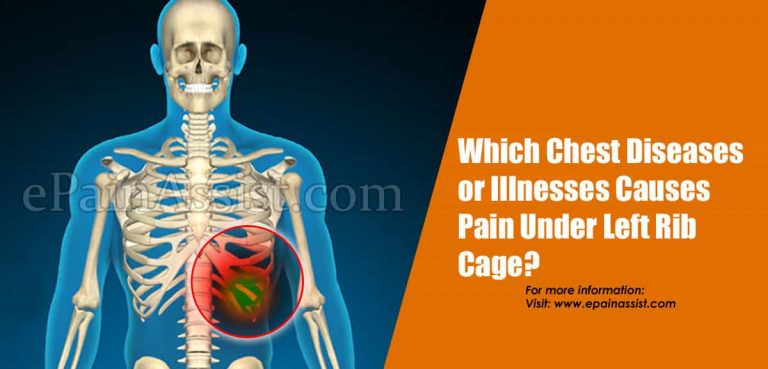 Which Chest Diseases or Illnesses Causes Pain Under Left Rib Cage?