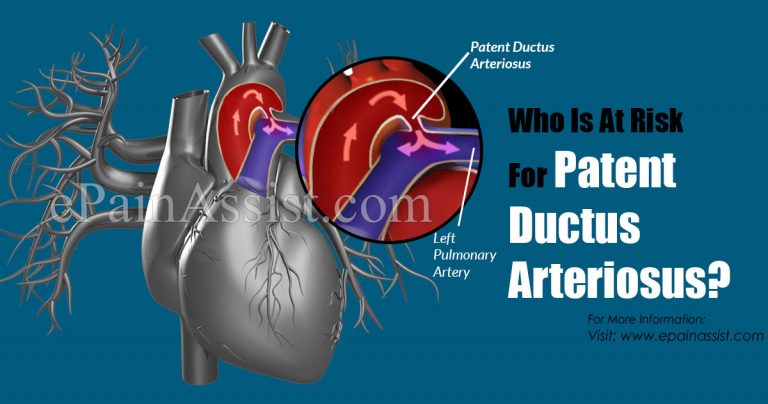 Who Is At Risk For Patent Ductus Arteriosus & Is There A Blood Test For It?