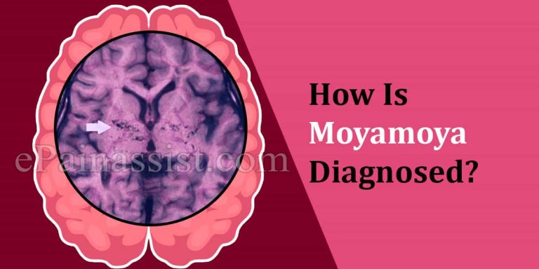 How Is Moyamoya Diagnosed?