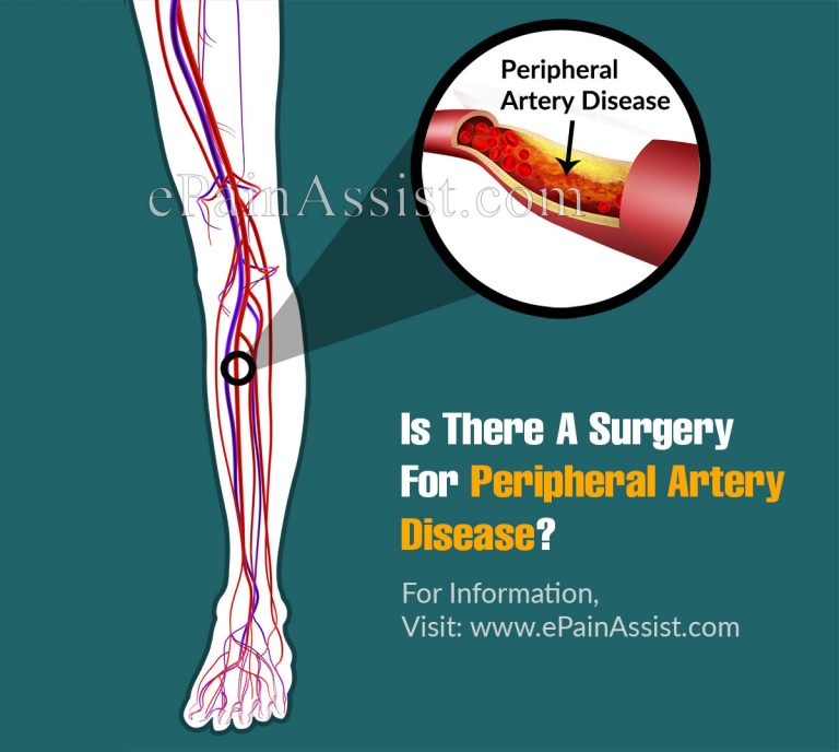 Is There A Surgery For Peripheral Artery Disease & Life Expectancy Of Someone With It?