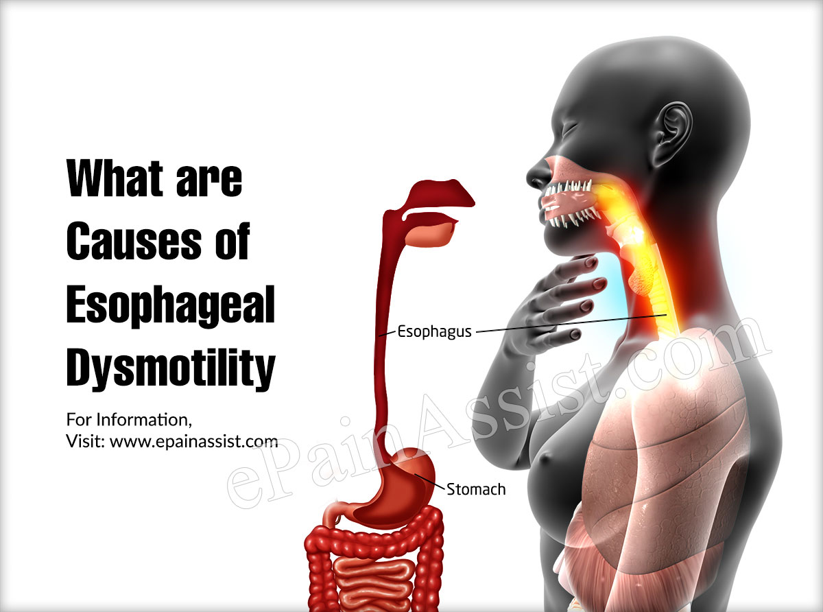 What are the Causes of Esophageal Dysmotility