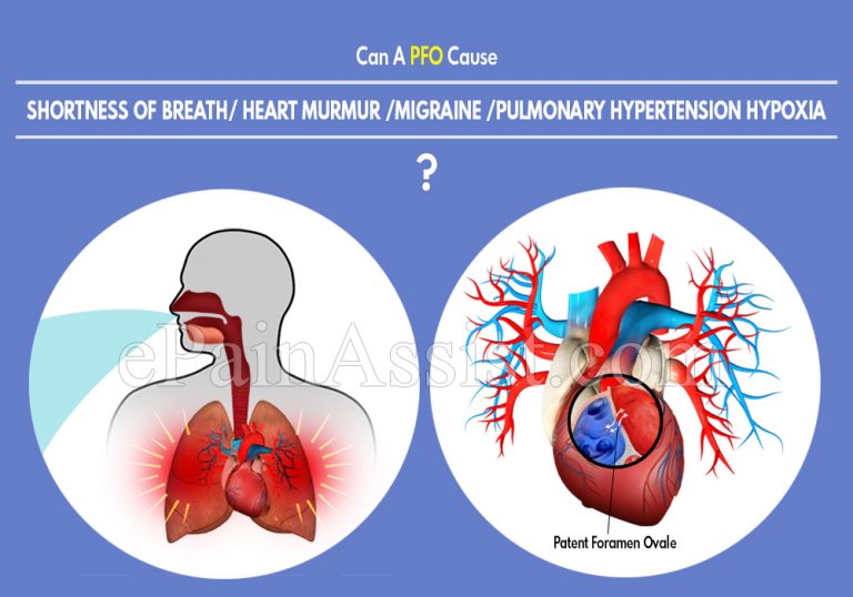 Can A PFO Cause Shortness Of Breath/ Heart Murmur /Migraine /Pulmonary Hypertension Hypoxia?