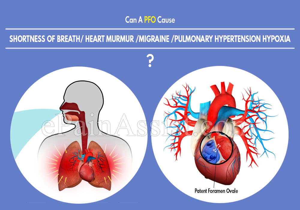 Can A PFO Cause Shortness Of Breath/ Heart Murmur /Migraine /Pulmonary Hypertension Hypoxia?