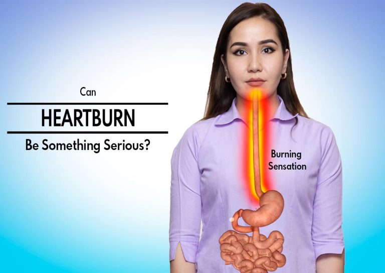 Can Heartburn Be Something Serious?