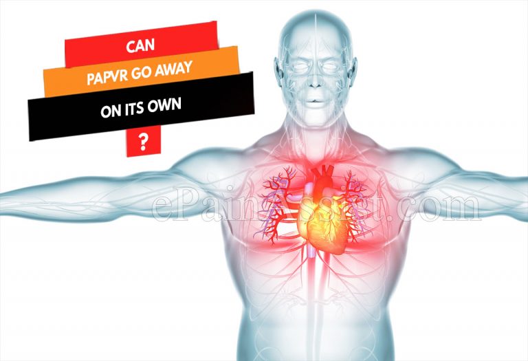Can PAPVR Go Away On Its Own & What Are Its Natural Remedies?
