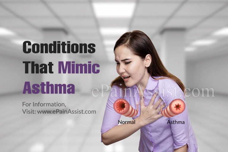 Conditions That Mimic Asthma