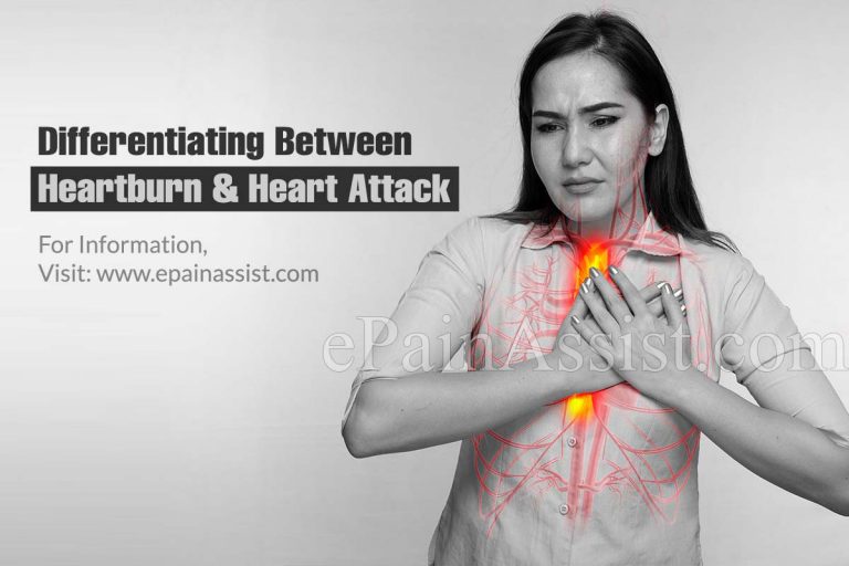 Differentiating Between Heartburn and Heart Attack