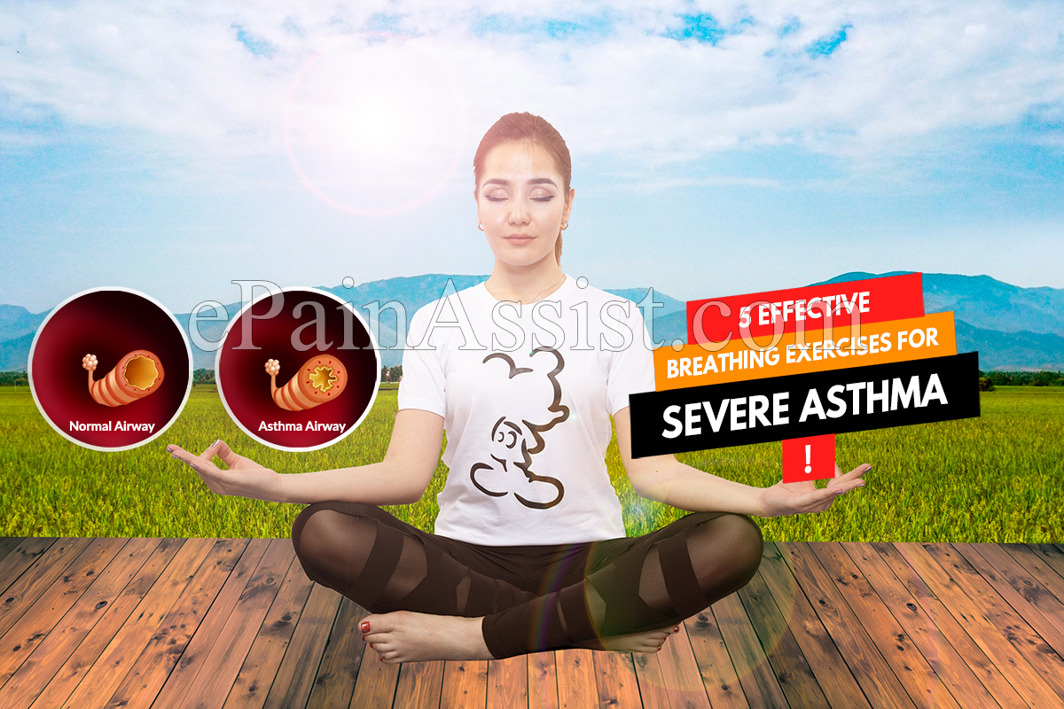 Effective Breathing Exercises for Severe Asthma