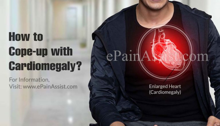 How to Cope-up with Cardiomegaly?