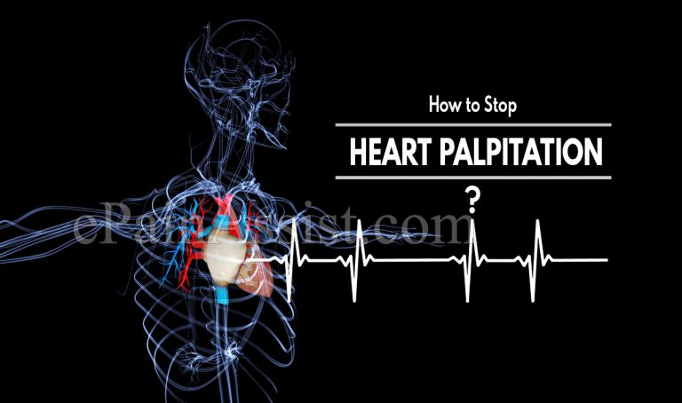 How to Stop Heart Palpitation?