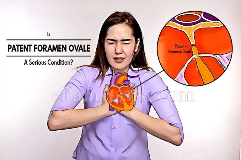 Is Patent Foramen Ovale A Serious Condition & Can It Be Reversed?