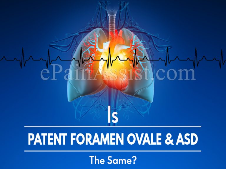 Is Patent Foramen Ovale & ASD (Atrial Septal Defect) The Same & Does PFO Cause Arrhythmia?