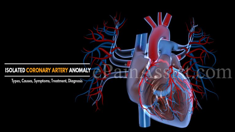 Isolated Coronary Artery Anomaly : Types, Causes, Symptoms, Treatment, Diagnosis