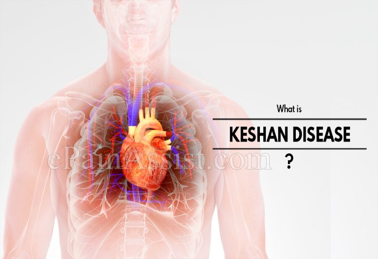 Keshan Disease
