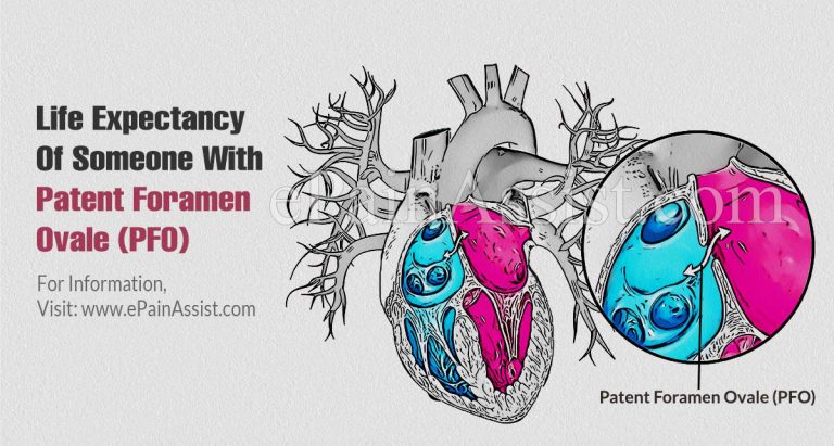 Life Expectancy Of Someone With Patent Foramen Ovale & Is PFO A Disability?
