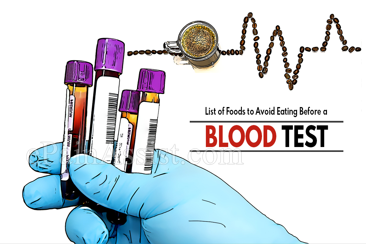 List of Foods to Avoid Eating Before a Blood Test