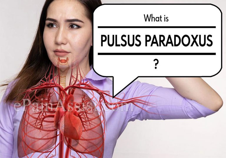 Pulsus Paradoxus and Asthma