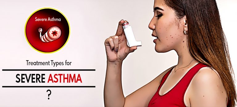 Treatment Types for Severe Asthma