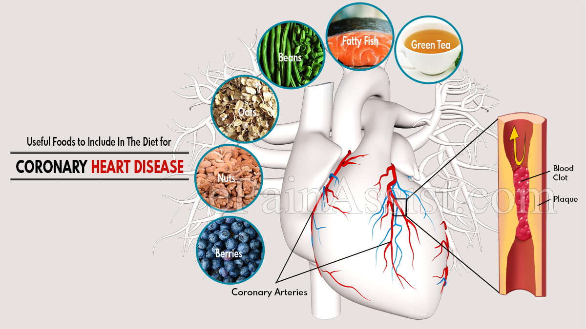 6 Useful Foods to Include In The Diet for Coronary Heart Disease (CAD)