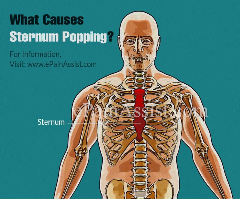 What Causes Sternum Popping and What Are The Treatment Options?