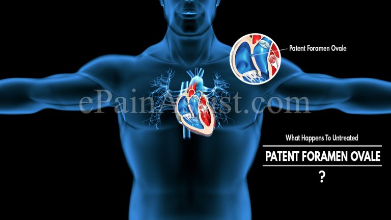 What Happens To Untreated Patent Foramen Ovale & When To Go To Doctor & Is It Progressive?