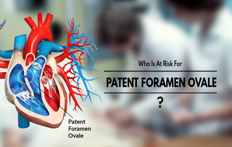 Who Is At Risk For Patent Foramen Ovale & Is There A Blood Test For It?