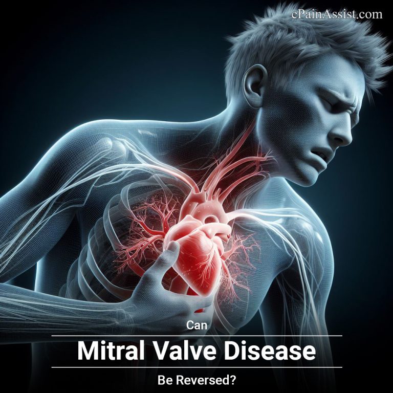 Can Mitral Valve Disease Be Reversed?