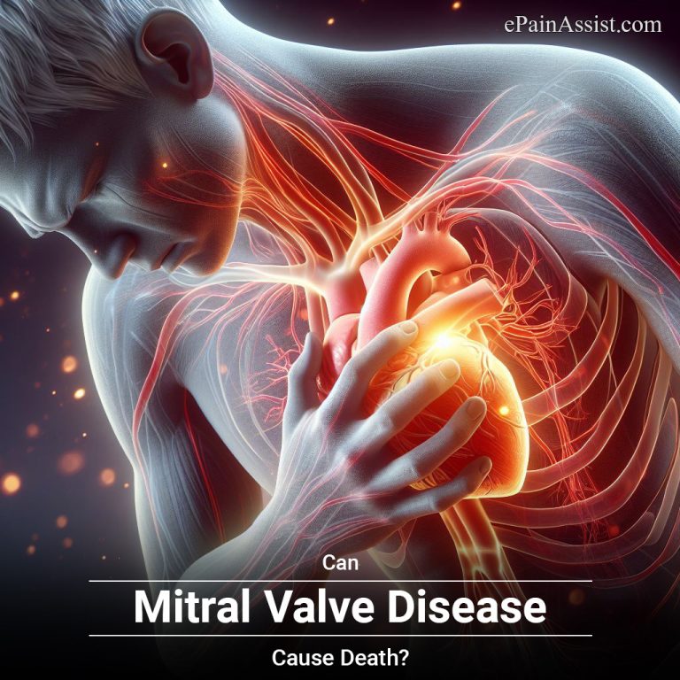 Can Mitral Valve Prolapse Cause Death?