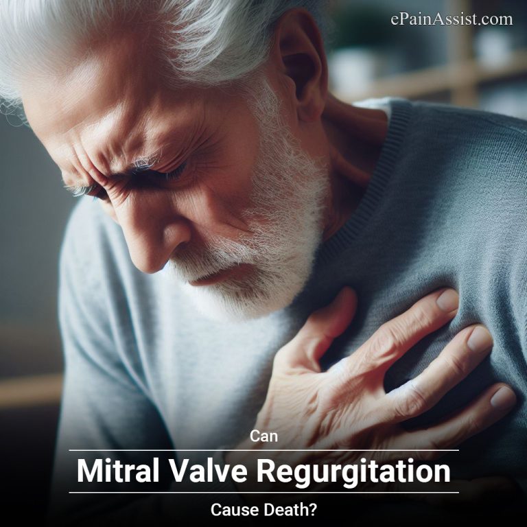Can Mitral Valve Regurgitation Cause Death?