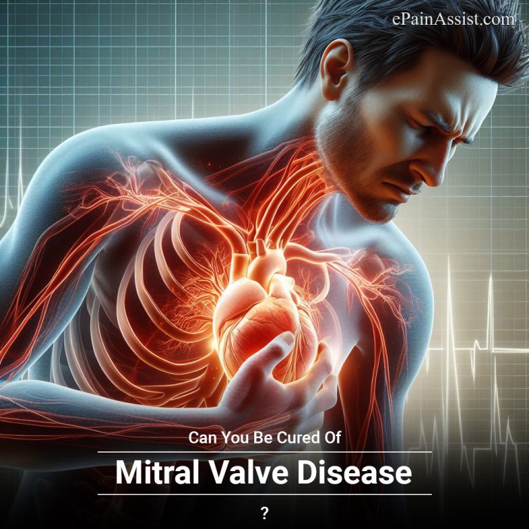 Can You Be Cured Of Mitral Valve Disease?