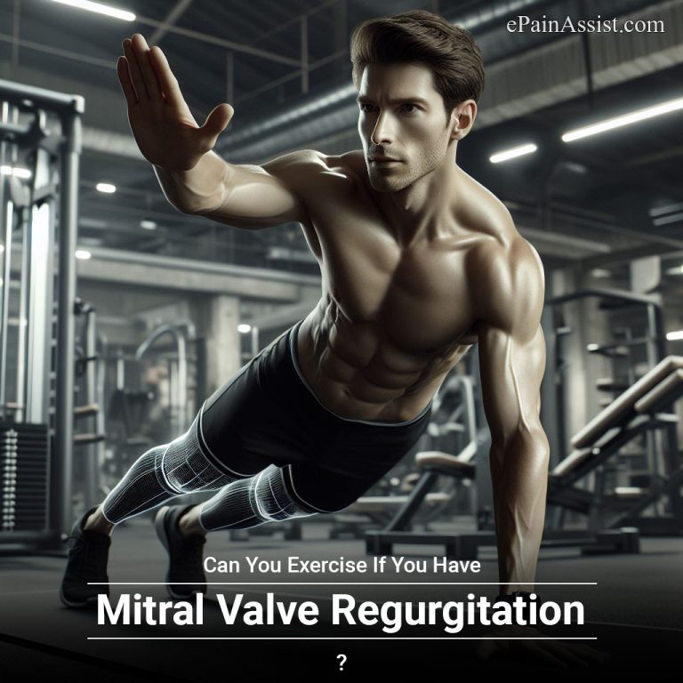 Can You Exercise If You Have Mitral Valve Regurgitation?