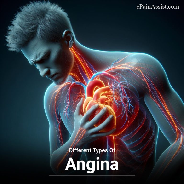Different Types Of Angina & The Most Common Type of Angina