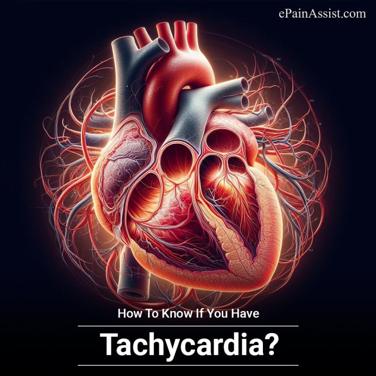How To Know If You Have Tachycardia?