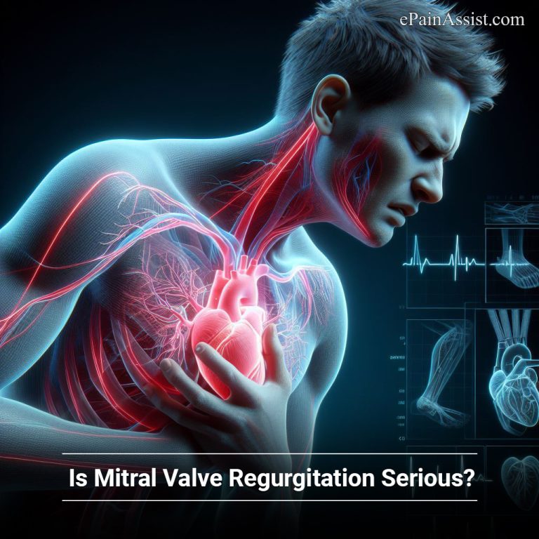 Is Mitral Valve Regurgitation Serious?