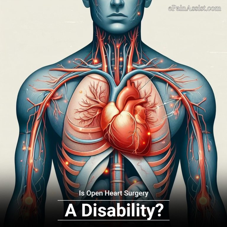 Is Open Heart Surgery A Disability?