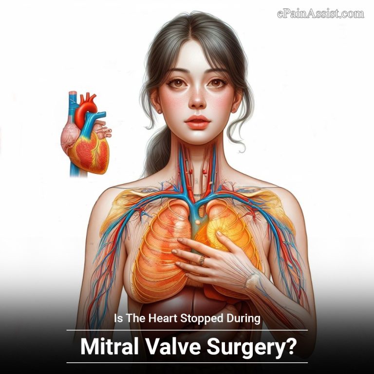 Is The Heart Stopped During Mitral Valve Surgery?