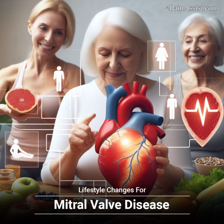 Lifestyle Changes For Mitral Valve Disease